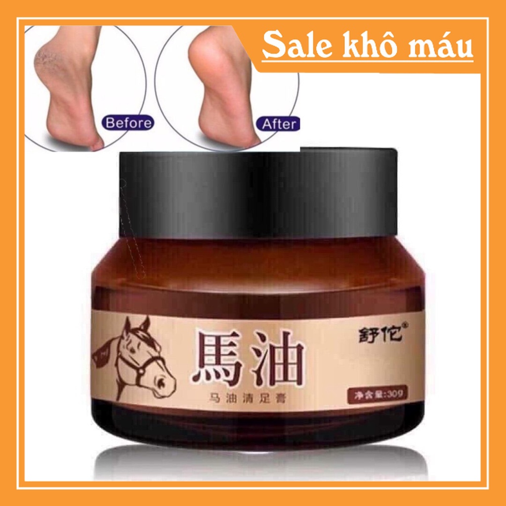 Kem dầu ngựa bôi tay chân, cao ngựa giảm khô nứt nẻ gót chân á sừng bong da - ngaanh_shop