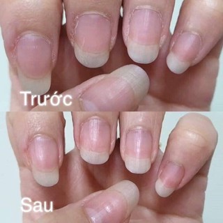 Dưỡng Móng hãng Candy Nail-𝗗𝗥. 𝗖𝗔𝗥𝗘+ 𝗣𝗥𝗢𝗧𝗘𝗜𝗡 𝗖𝗔𝗥𝗘
