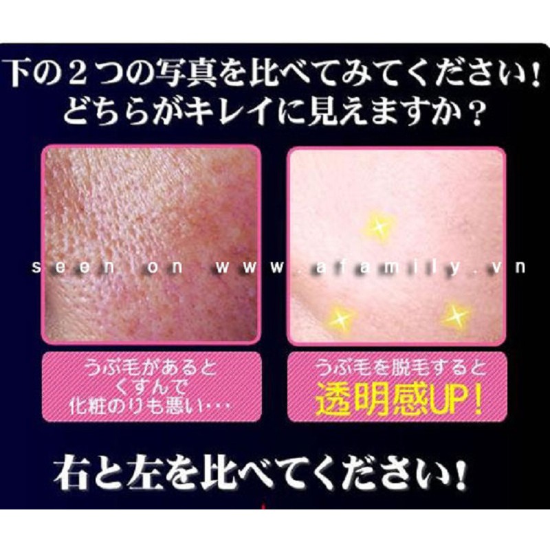 Cây Se Lông Mặt, Mép | BigBuy360 - bigbuy360.vn