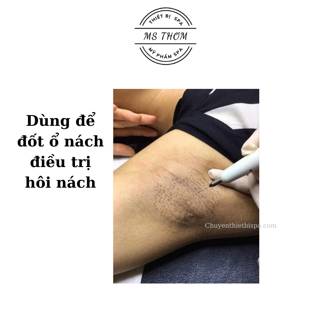 Kim đốt mụn ruồi, mụn thịt, đốt ổ nách chuyên dùng trong spa