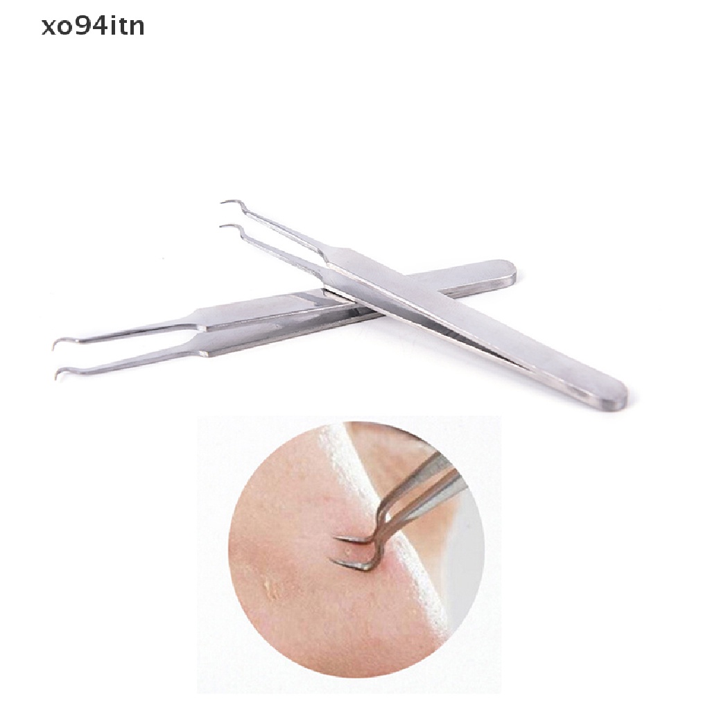 Kẹp Loại Bỏ Mụn Đầu Đen Làm Sạch Da Mặt Tiện Dụng