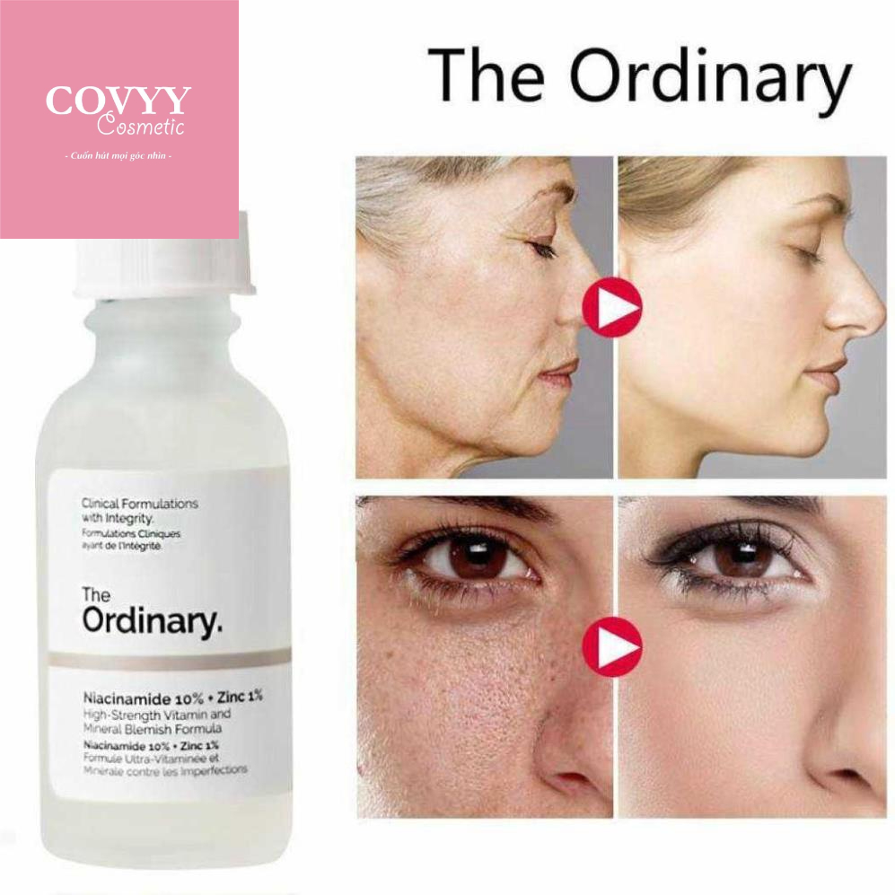 Tinh Chất Xóa Thâm Mụn Và Dưỡng Trắng Da The Ordinary Niacinamide 10% + Zinc 1%