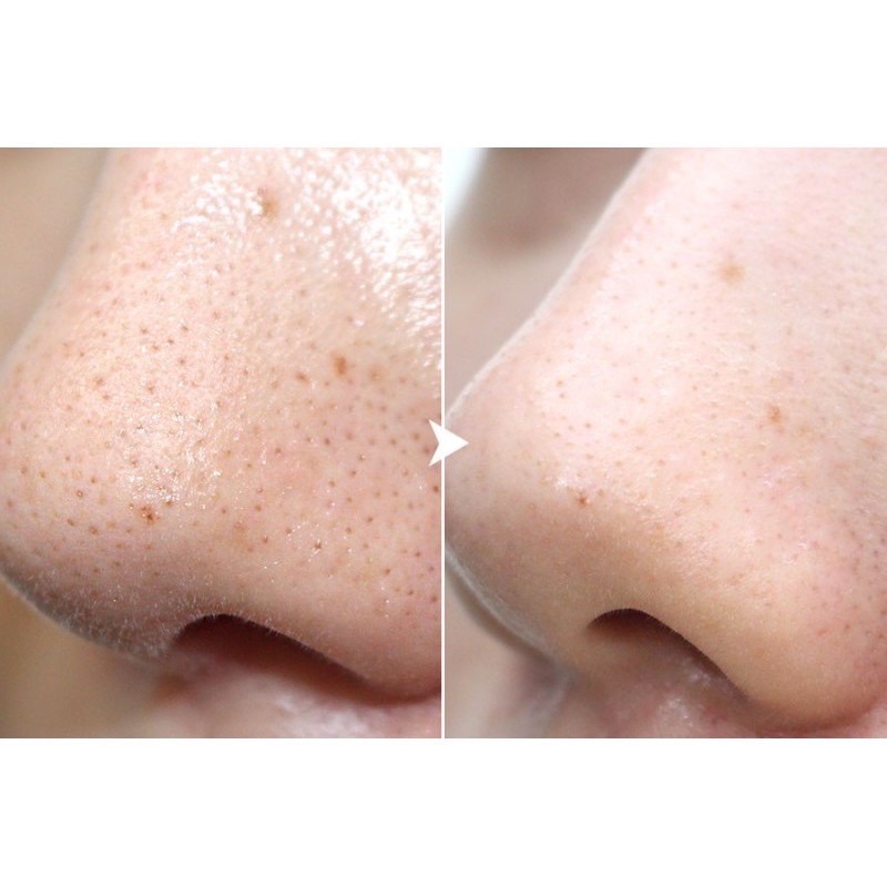 Toner The Ordinary glycolic acid 7% 240ml Toning Solution | BigBuy360 - bigbuy360.vn