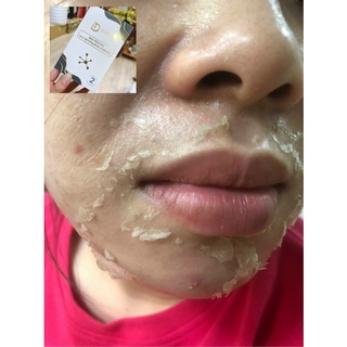 Peel da retinol vi tảo - trang nemo.