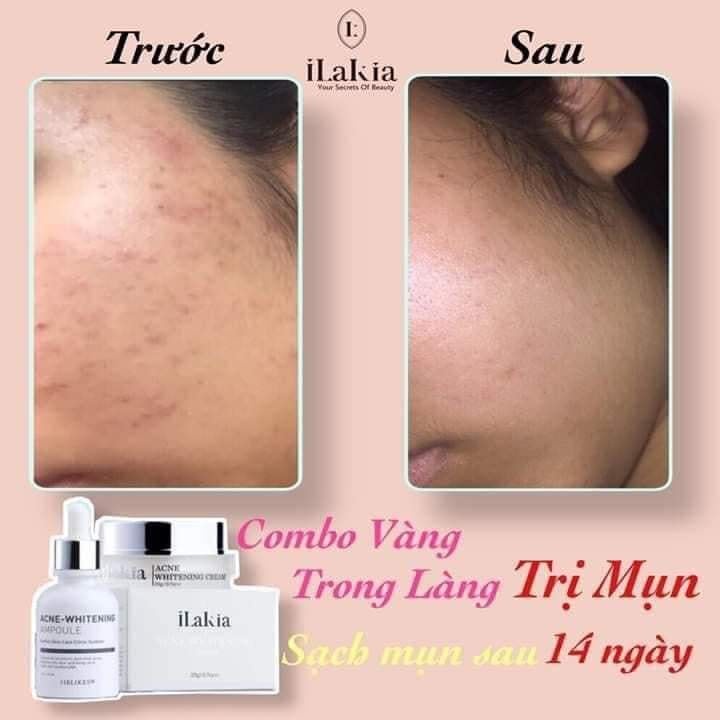 Kem Giảm Mụn Trà Tràm ILAKIA Dưỡng Ẩm Liên Sẹo Dưỡng Trắng Ngăn Ngừa Lão Hoá Hàn Quốc 20g | BigBuy360 - bigbuy360.vn