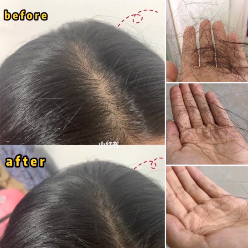 [NỘI ĐỊA ĐỨC] Dầu gội xả Biotin Collagen tím ngăn ngừa rụng tóc kích thích mọc tóc, 385ml (2 tem)