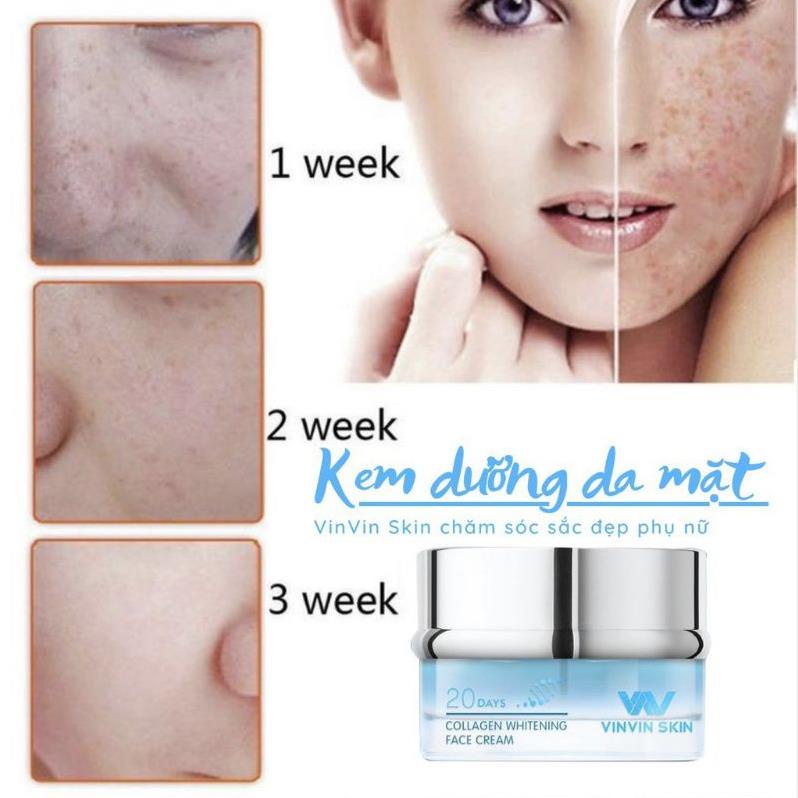 (Chính Hãng) Kem  Dưỡng Trắng, Phục Hồi Hư Tổn Làn Da VINVIN SKIN 30g | BigBuy360 - bigbuy360.vn