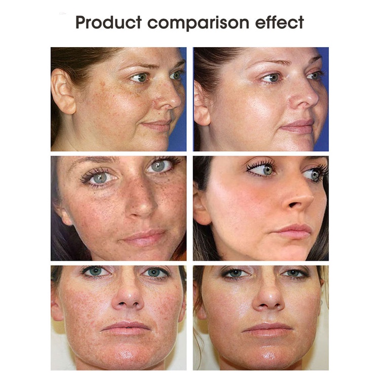 Kem Vitamin C 20% Làm Trắng Xóa Đốm Đen Trên Da Mặt Hiệu GLAMN