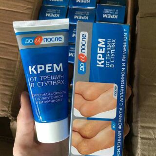 Kem trị nứt gót chân Kpem