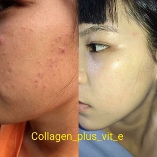 Kem collagen plus vit E