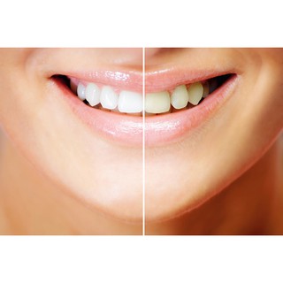 Bút Tẩy trắng răng Dazzling White - Bút Tẩy Răng Thần Kỳ Hiệu Quả Sau 7 Ngày Sử Dụng