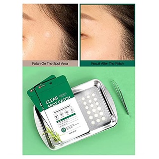 Some BY MI Clear Spot Patch 18 Miếng x 10
