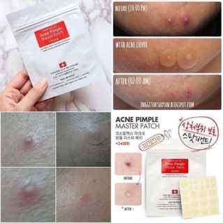 Miếng dán mụn COSRX ACNE PIMPLE MASTER PATCH