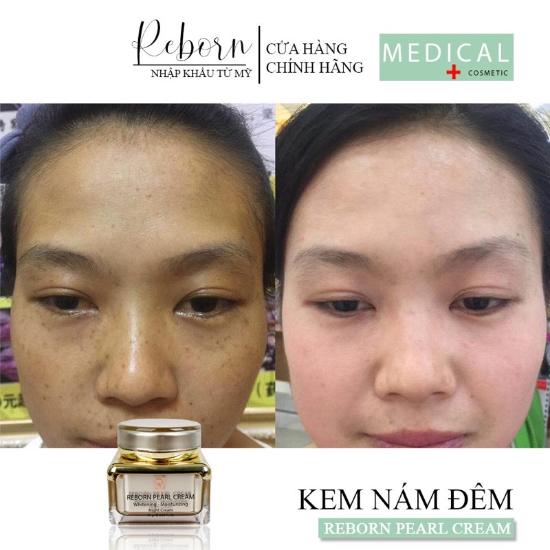 Kem Nám Đêm Reborn Dưỡng Trắng Dành Cho Da Nám_25gr