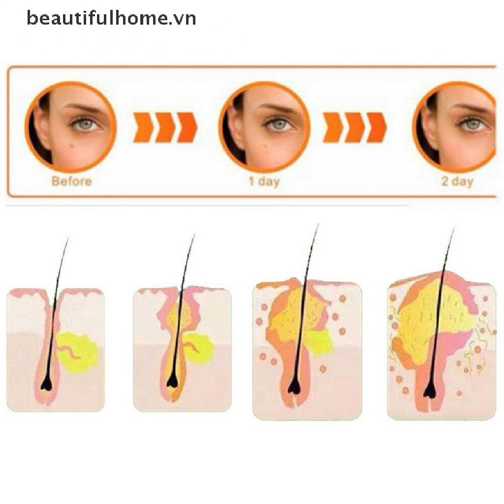 Set 36 Kem Hỗ trợ giảm mụn Hiệu Quả Chăm Sóc Da