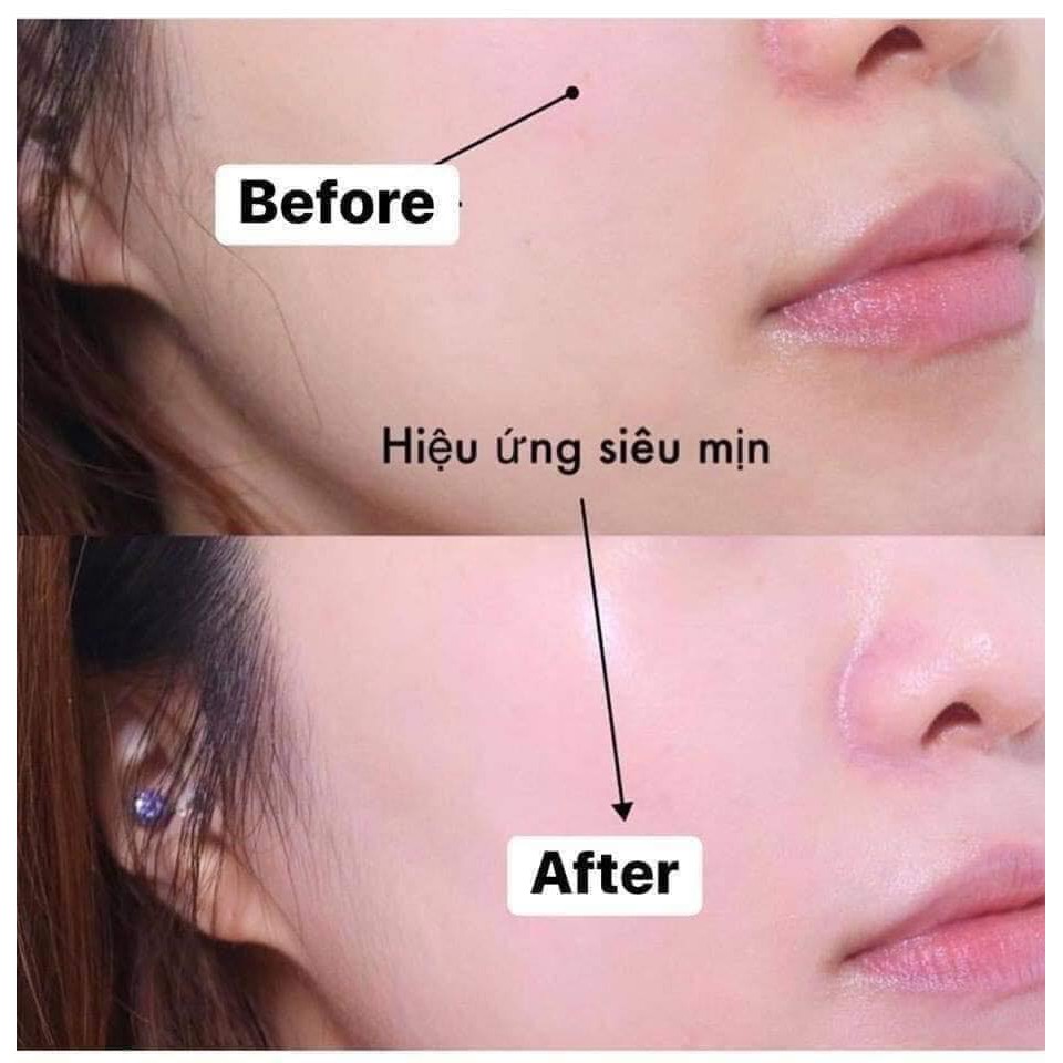 (chính hãng) 𝐊𝐞𝐦 𝐜𝐡𝐨̂́𝐧𝐠 𝐧𝐚̆́𝐧𝐠 #Cell_fusion_C Toning hồng