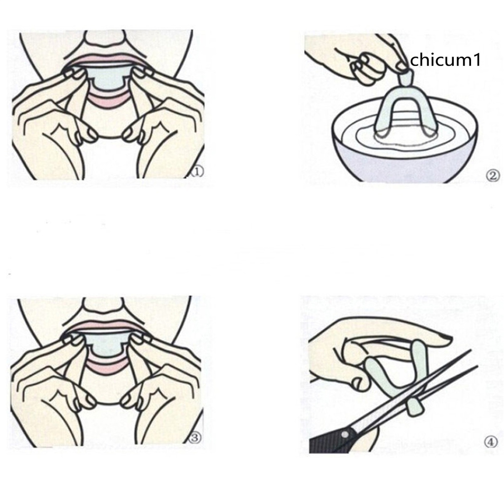 [Hàng mới về] Cặp khay silicon hỗ trợ làm trắng răng