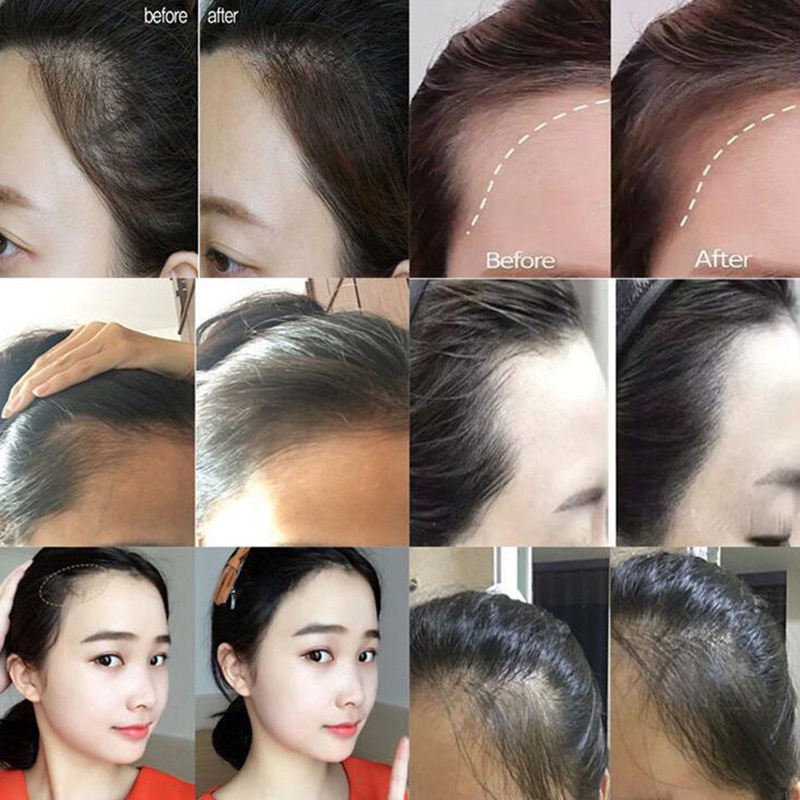 [Hàng mới về] Set 2 phấn phủ tóc che khuyết điểm Sevich màu đen tự nhiên