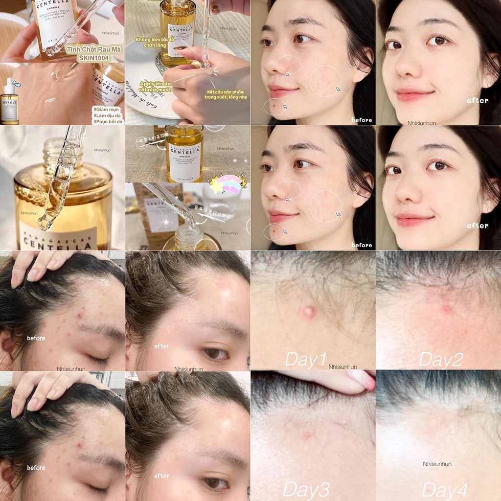 Serum rau má Skin1004 Madagascar Centella Asiatica 100 Ampoule