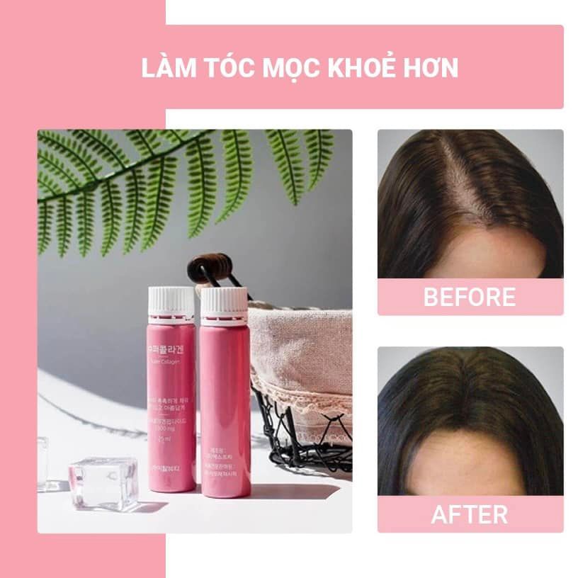 Nước Uống Collagen Hỗ Trợ Làm Đẹp, Ngăn Ngừa Lão Hóa Vital Beautie Super, Collagen VB HÀN QUỐC - ALISA