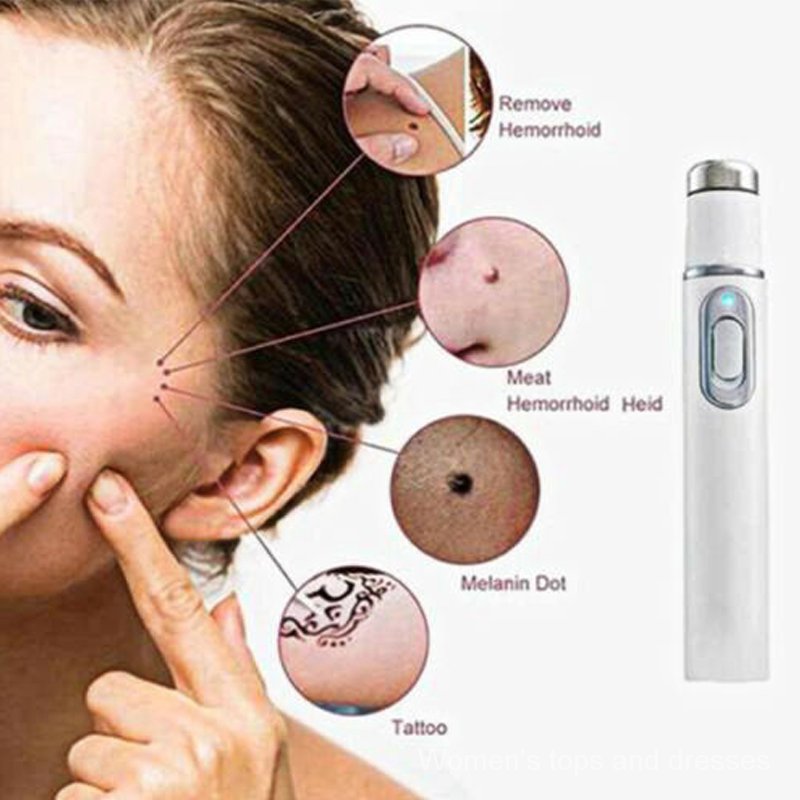 (Hàng Mới Về) Bút Laser Trị Mụn Trứng Cá / Mạng Nhện 4joi Tiện Dụng