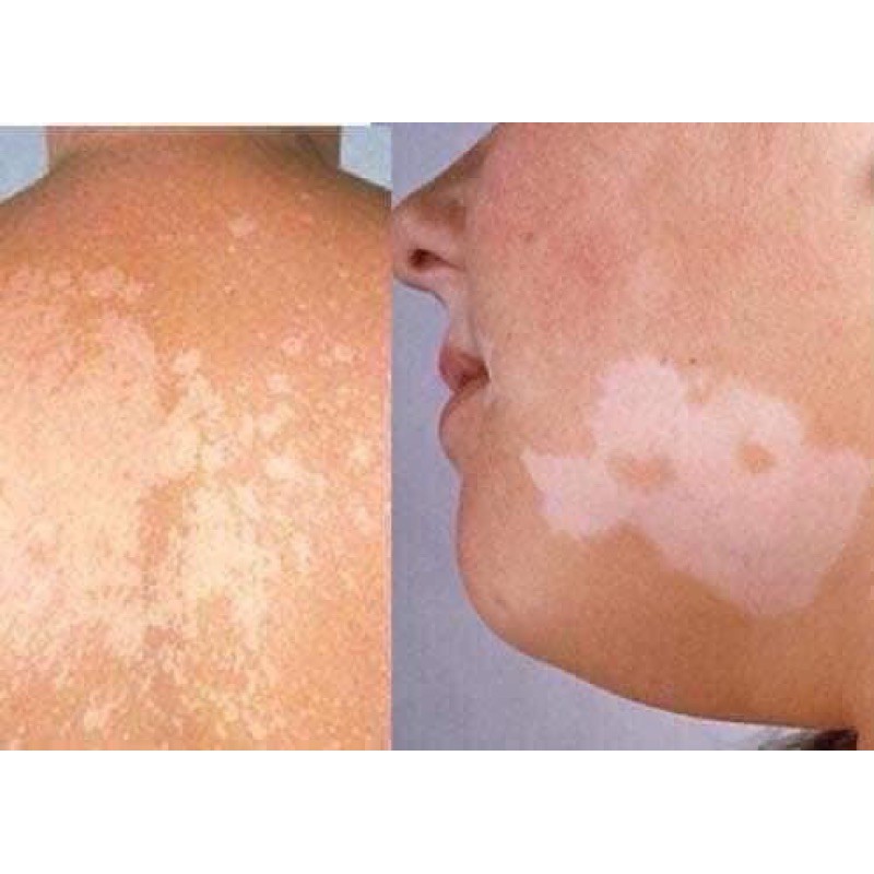 Kem bôi lang ben fango b thái lan