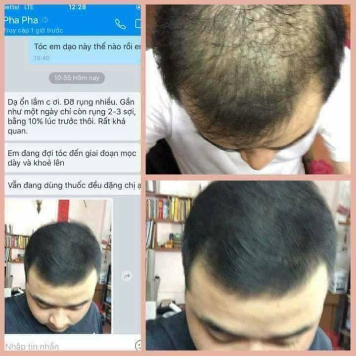 Tinh dầu thảo dược kích thích mọc tóc - Đinh Hương Nhu 120ML - Chai Lớn | BigBuy360 - bigbuy360.vn