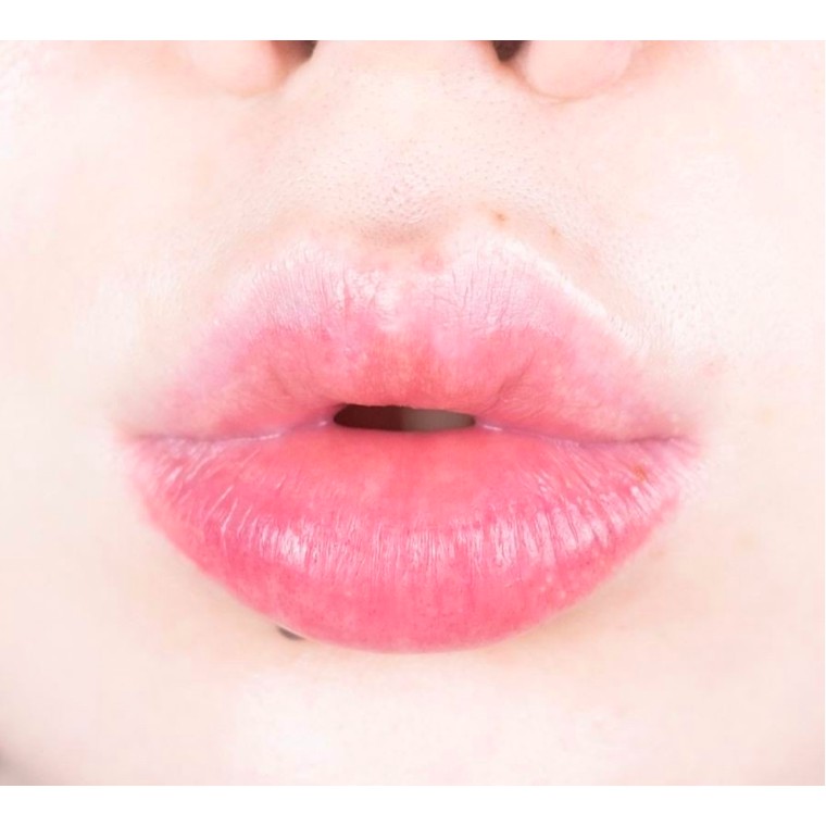 Mặt nạ môi dưỡng ẩm, mờ thâm cho môi hồng hào, mềm mại Hàn Quốc Dearmay Vita Hydrogel Lip Patch