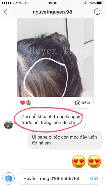 [MẪU MỚI] TINH DẦU BƯỞI MỌC TÓC CHÍNH HÃNG | BigBuy360 - bigbuy360.vn