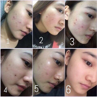 Lotion “ Nước Thần “ Sake Kuramoto Bijin - Nhật