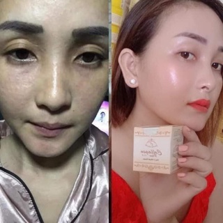 Kem nám trắng da mặt Colagen 701 plus vit e