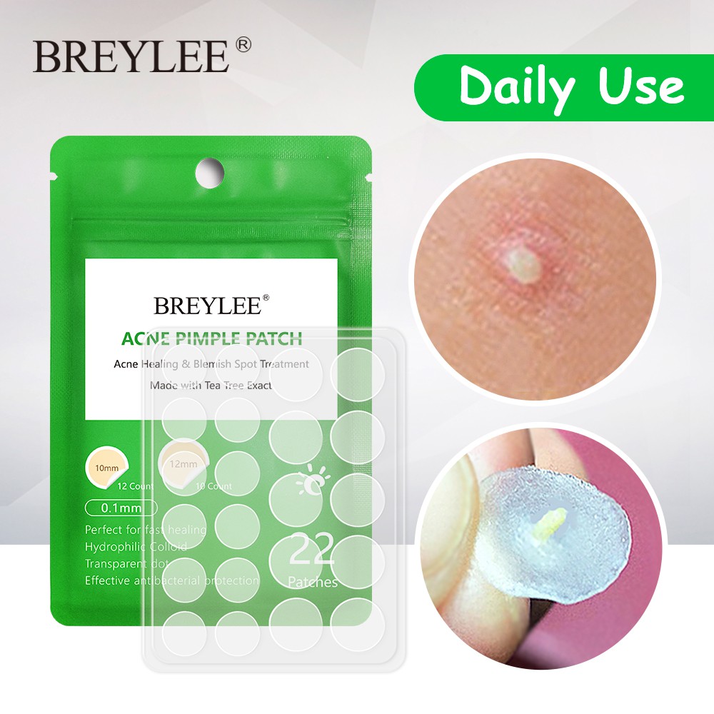 Bộ 6 Sản Phẩm Chăm Sóc Da BREYLEE Gồm Serum Kem Pimples Patch