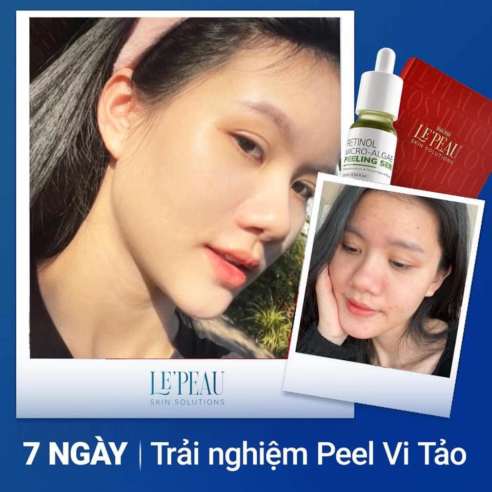 Peel Da Retinol Vi Tảo 10ml, Tinh Chất Tái Tạo Da Sinh Học Căng Bóng Chính Hãng, Tặng Kèm Serum B5 Phục Hồi - LE'PEAU