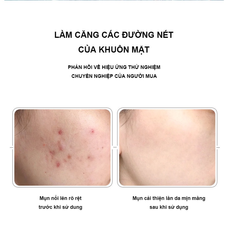 Máy massage mặt, đẩy tinh chất ánh sáng sinh học chăm sóc với công nghệ mới đa chức năng