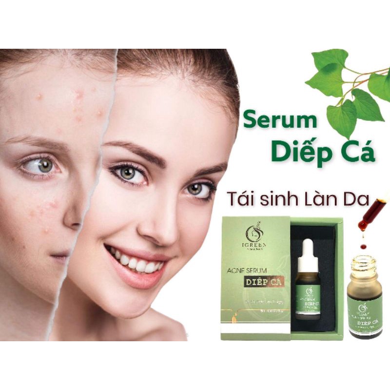 SERUM DIẾP CÁ ( HÀNG CHÍNH HÃNG )