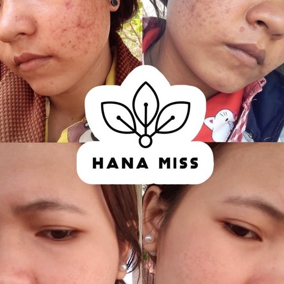 Bột rửa mặt Linh Chi Hana Miss ☘CHÍNH HÃNG☘ an toàn cho mọi loại da | BigBuy360 - bigbuy360.vn