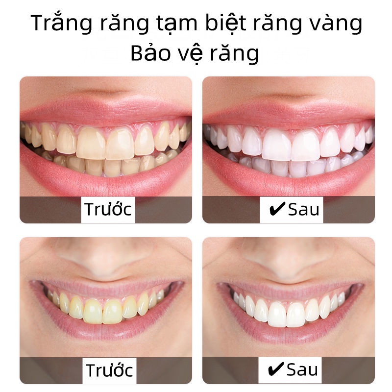 [CHÍNH HÃNG] [HCM]BREYLEE Bột Tẩy Trắng Răng Làm Trắng Răng Vệ Sinh Răng loại  bỏ mảng bám/vết ố Chuyên Sâu 30g hot sale