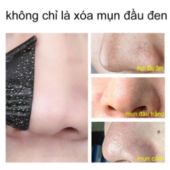 Mặt nạ mặt nạ dưỡng trắng da lột mụn đầu đen 50ML Làm sạch sâu da loại bỏ mụn đầu đen làm trắng da mặt