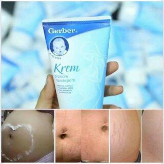 Kem rạn da Gerber Krem 150ml