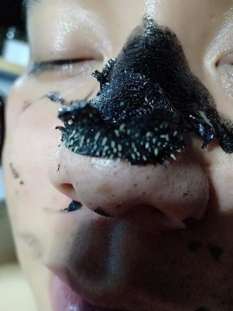 Gel lột hút mụn than tre ngân bình | Thế Giới Skin Care