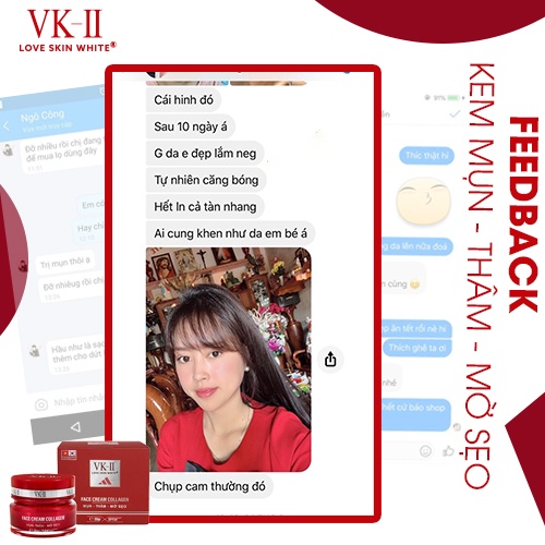 Kem dưỡng da giảm mụn mờ thâm sẹo VK-II Love Skin White Face Cream Collagen 20g