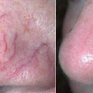 Tế bào thực vật siêu phục hồi da