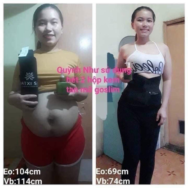 Kem Tan Mỡ Bụng Go Slim Chính Hãng Matxicorp