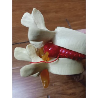 Mô hình thoát vị đĩa đệm - mô hình bệnh lý thoát vị đĩa đệm - mô hình đĩa đệm