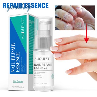 ✨YD❤ Nail Toe Repair Essence Anti Fungal Cracked Rough Repairing Moisturizing Finger Foot Care