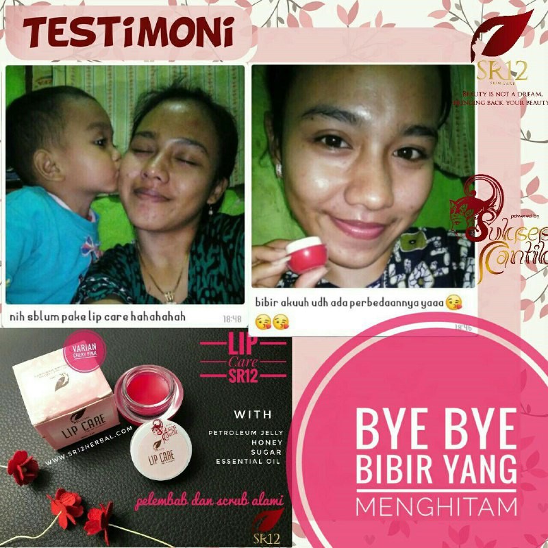 (hàng Mới Về) Serum Dưỡng Môi Vĩnh Cửu Nhanh Chóng An Toàn Sr12 | BigBuy360 - bigbuy360.vn