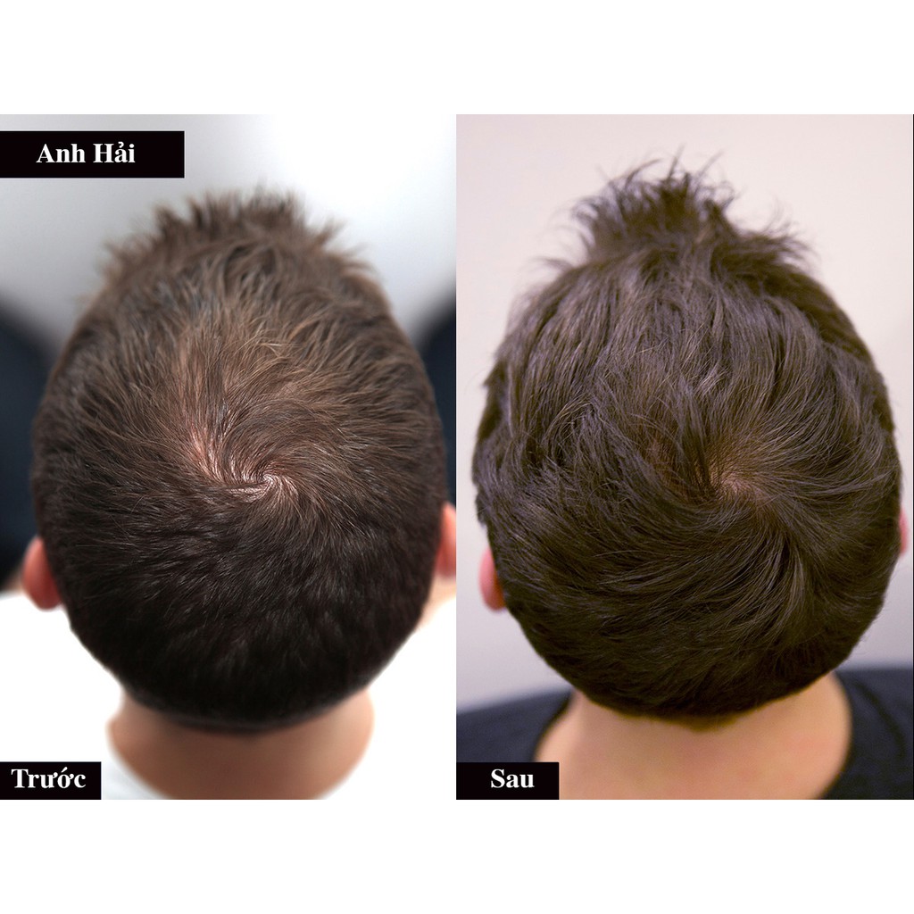 Tinh dầu bưởi dạng xịt, serum bưởi chống rụng tóc và kích thích mọc tóc 110ml - HANDMADE - SR007 | BigBuy360 - bigbuy360.vn