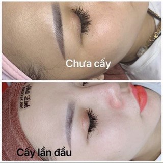 Cấy trắng tổ yến kim cương JANG WON mẫu mới nhất