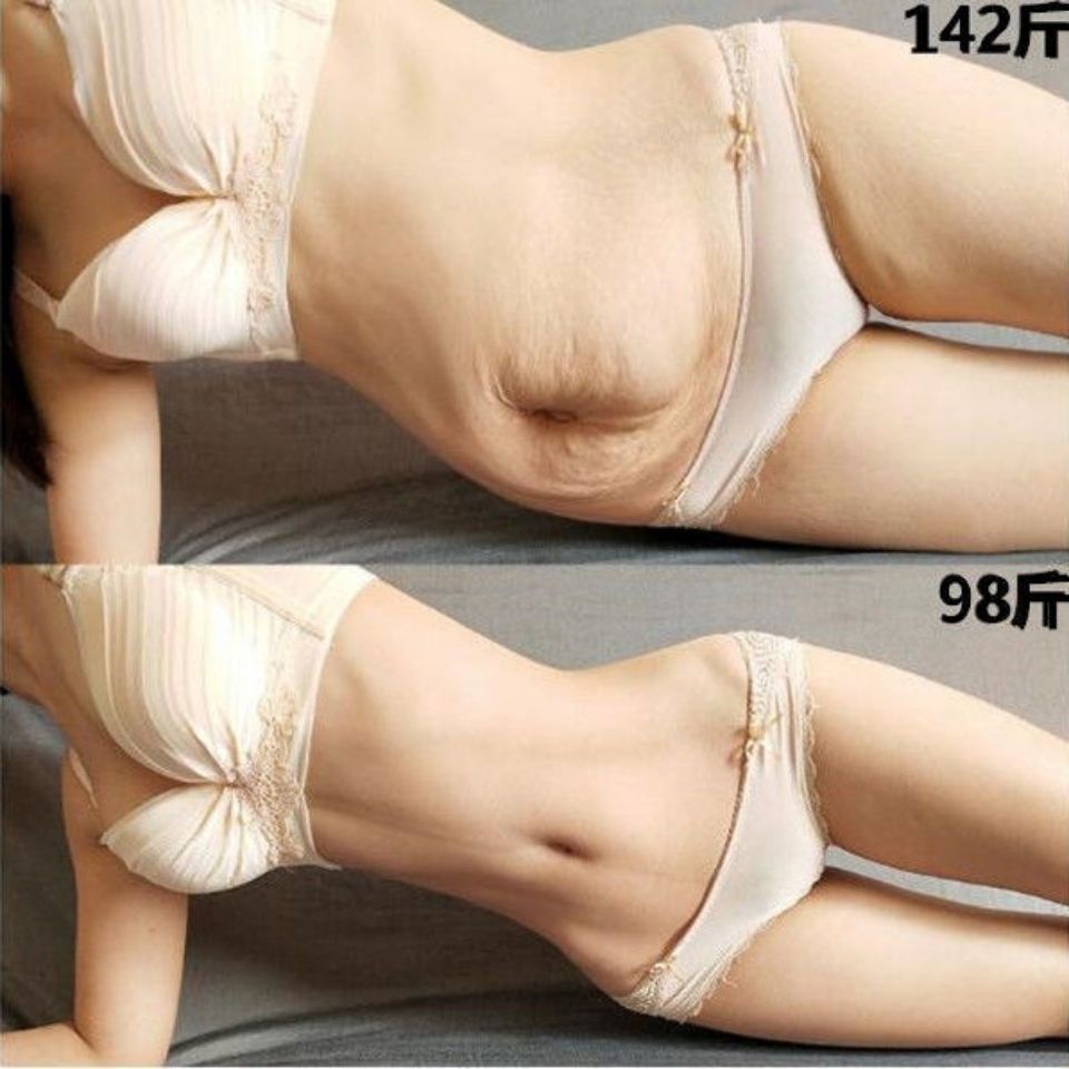 Kem Thảo Dược Đốt Cháy Mỡ Thừa Làm Săn Chắc Da Vùng Bụng / Chân / Bụng