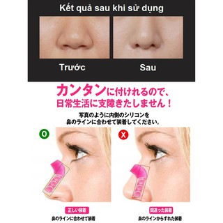 DỤNG CỤ NÂNG MŨI NOSE UP